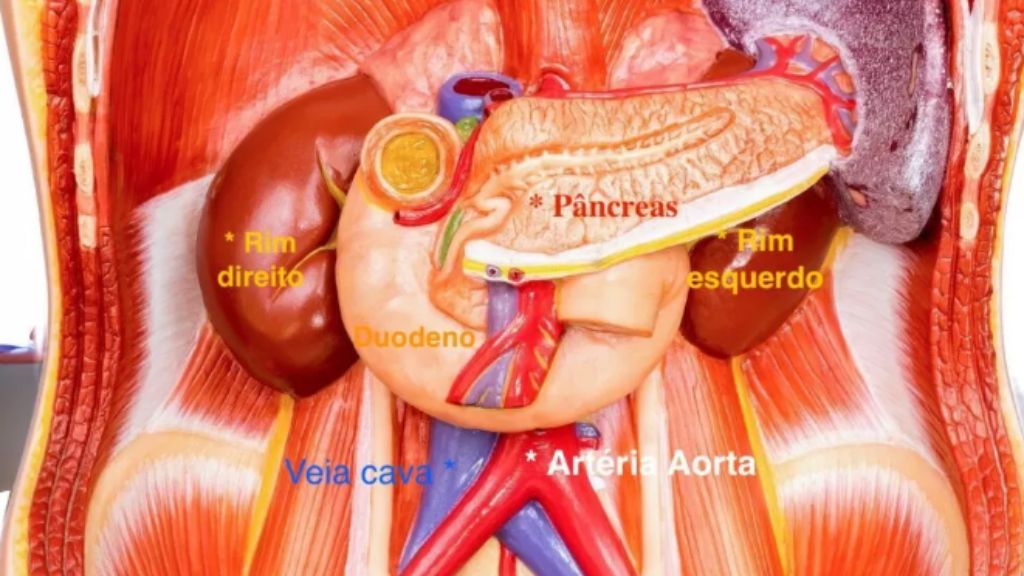 Sarcomas e Tumores Retroperitoneais Conheça Essas Condições